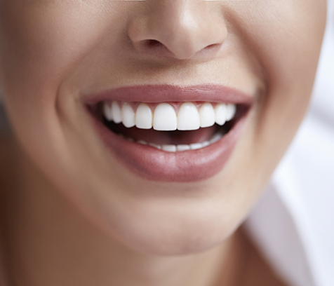 Close-up of teeth after teeth whitening