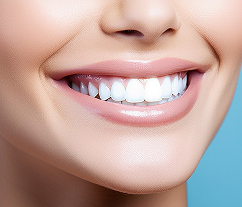 Close-up of woman's smile after full-mouth reconstruction